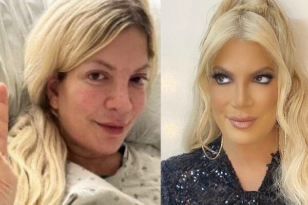 Tori Spelling In Ospedale Tramite Storia Instagram E Post Nei Feed Credits Via Instagram Torispelling