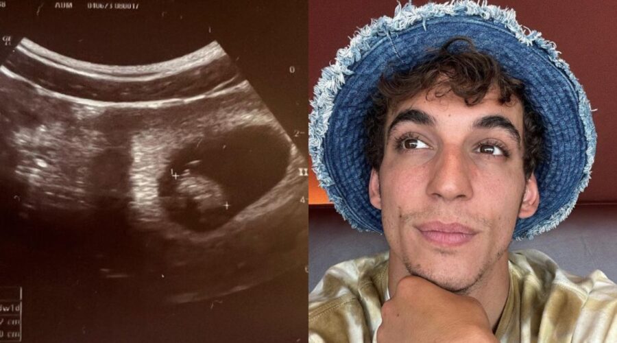 Da sinistra: l'ecografia pubblicata da Miguel Herrán (a destra) su Instagram. Credits: @miguel.g.herran/Instagram.